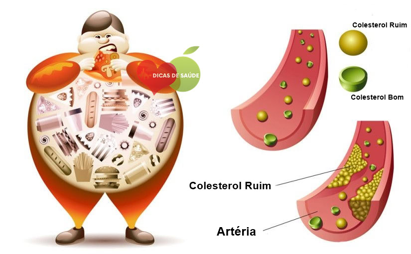 alimentos-que-reduzem-o-colesterol-e-prevenir-ataques-cardiacos-1 | Dicas de Saúde alimentos-que-reduzem-o-colesterol-e-prevenir-ataques-cardiacos-1