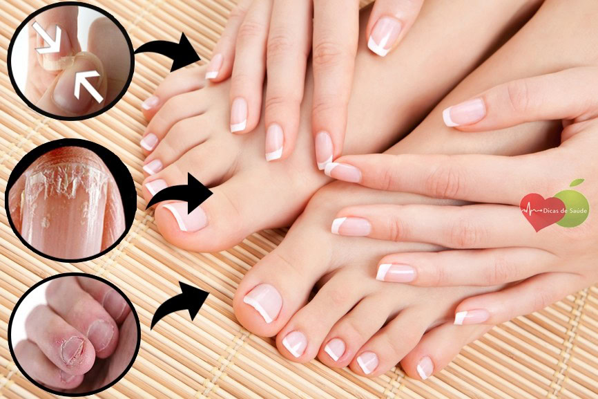 Truque com vinagre para deixar unhas lindas | Dicas de Saúde