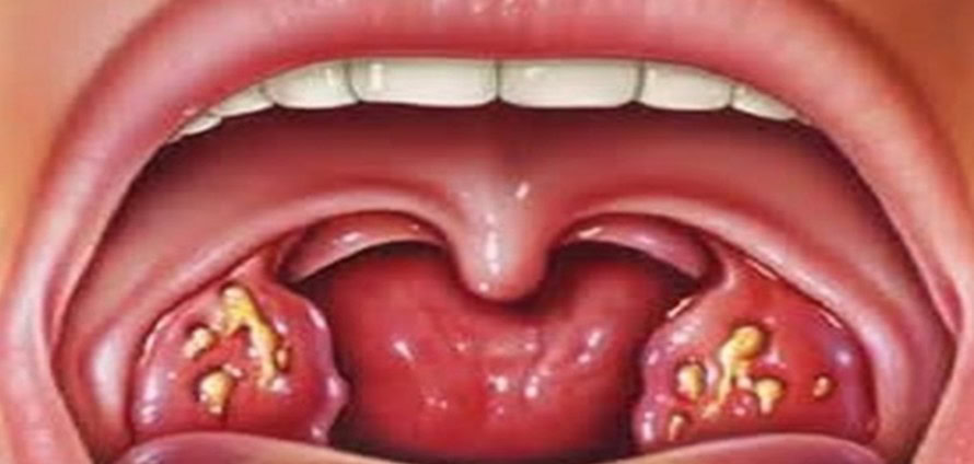 Acabe com a Dor e Inflamação | Dicas de Saúde Acabe com a Dor e Inflamação