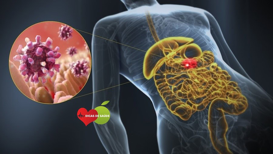 Receita Poderosa Para Curar Qualquer Infecção no Corpo | Dicas de Saúde