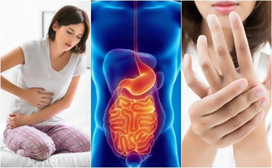 aditivos alimentares que desencadeiam o intestino permeavel