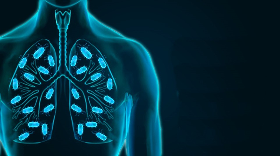 Tratar a Tuberculose | Dicas de Saúde Tratar a Tuberculose