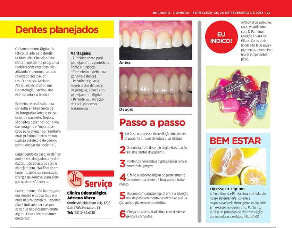 Clinica Adriano Abreu no caderno Buchicho 1 odontologia estetica em fortaleza