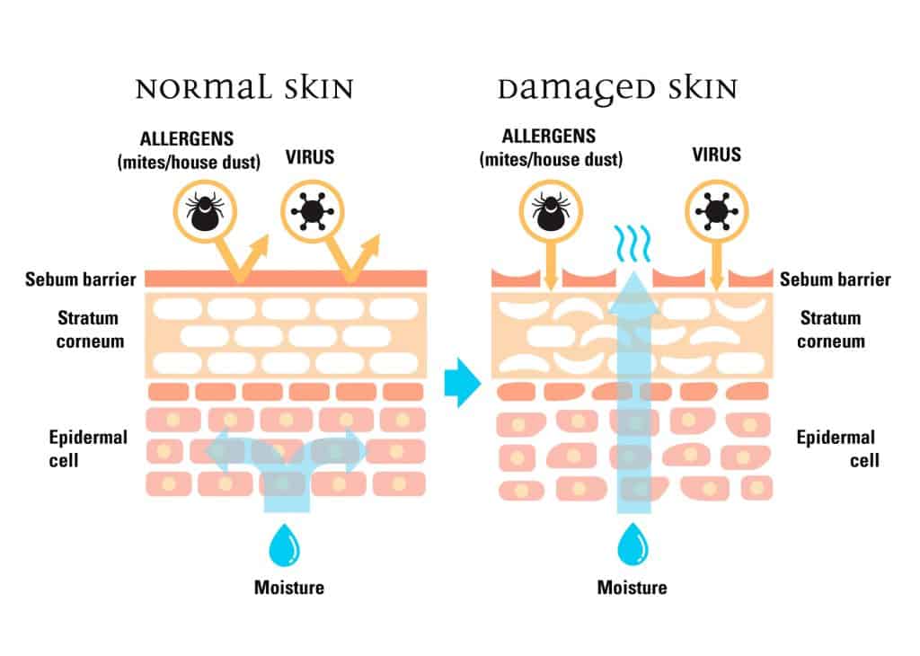 protective skin barrier