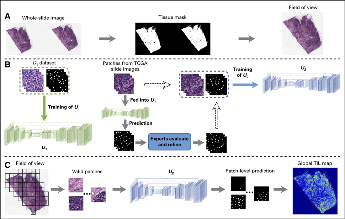 The pipeline for identification of tumor-infiltrating lymphocyte (TIL) maps on whole-slide histopathologic images. Image: Lu et al., 2020.