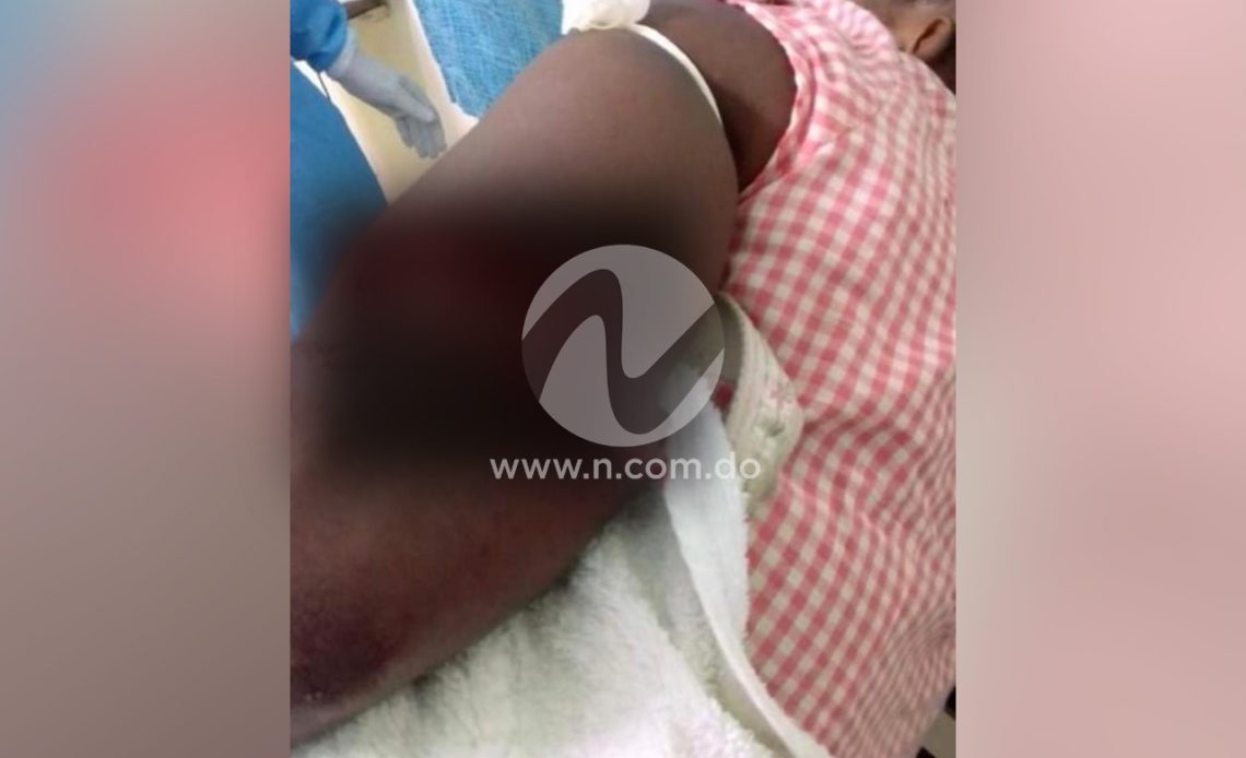 Brazo de Lady Antonia Ascencio Pérez