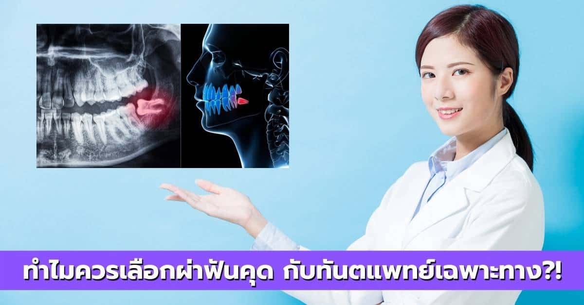 เลือกผ่าฟันคุด กับทันตแพทย์เฉพาะทาง