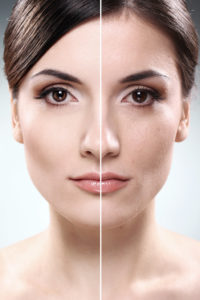 photosilk