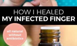 Pinterest pin with two images. The first image is of a woman putting a bandaid on her finger. The second image is of a bottle of essential oil sitting on a counter with herbs. Text overlay says, "How I healed my infected finger: all natural without antibiotics".