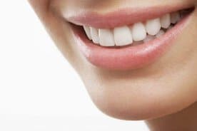 sorriso branco