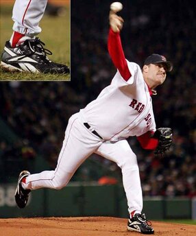 7 Leadership Lessons from one of the Greatest Comebacks in Sports History 5 Curt Schilling showed leadership by example when he pitched hurt.