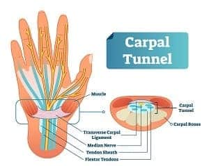 Piano Playing And Preventing Carpal Tunnel Joshua Ross