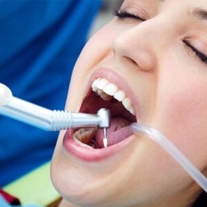 Periodoncia limpieza de encías para periodoncia en clinica dental de vicente ortodoncia granada