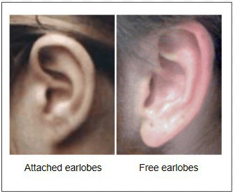 Attached versus free earlobes