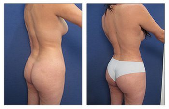Tilde Curve for waistline definition