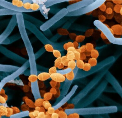bacterias Lactobacillus bulgaricus y Streptococcus thermophilus bacterias Lactobacillus bulgaricus y Streptococcus thermophilus