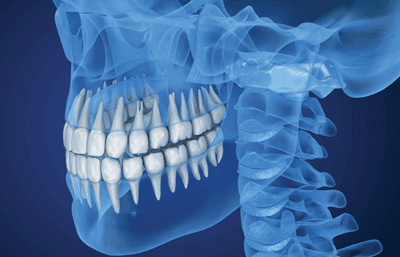 Advanced Dental Technology