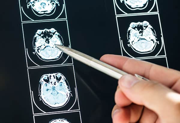 Opisy badań diagnostycznych wielkopolska