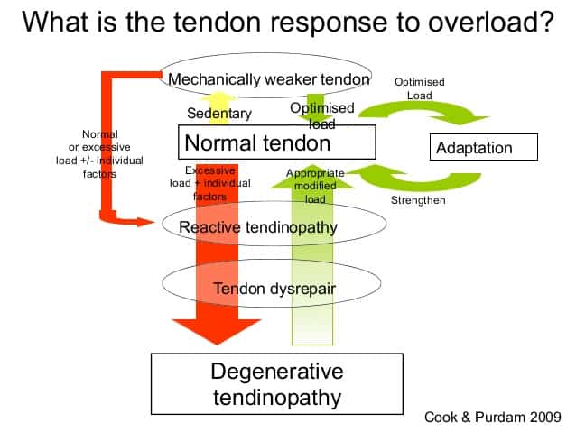 diagram of achilles tendinopathy pathology