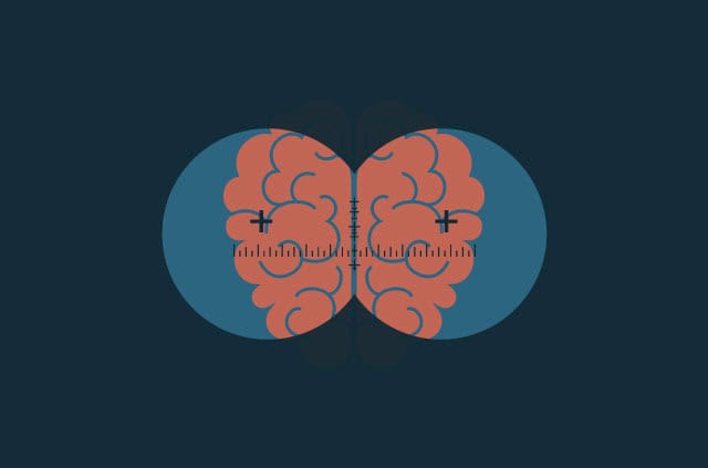 brain-computer-privacy Bird's-eye view of a brain seen through military binocular vision.