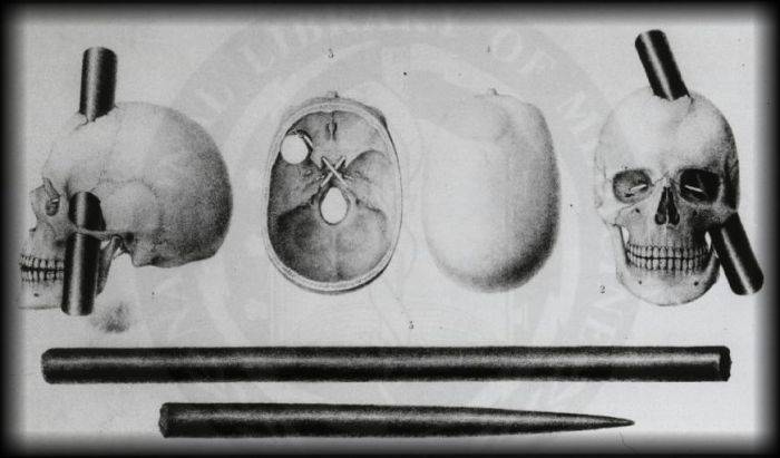 Phineas Gage