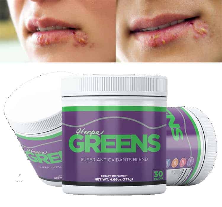 HerpaGreens Review