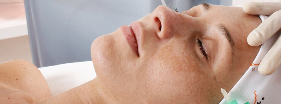 carboxiterapia
