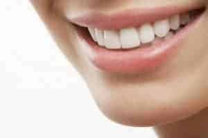 sourire blanc