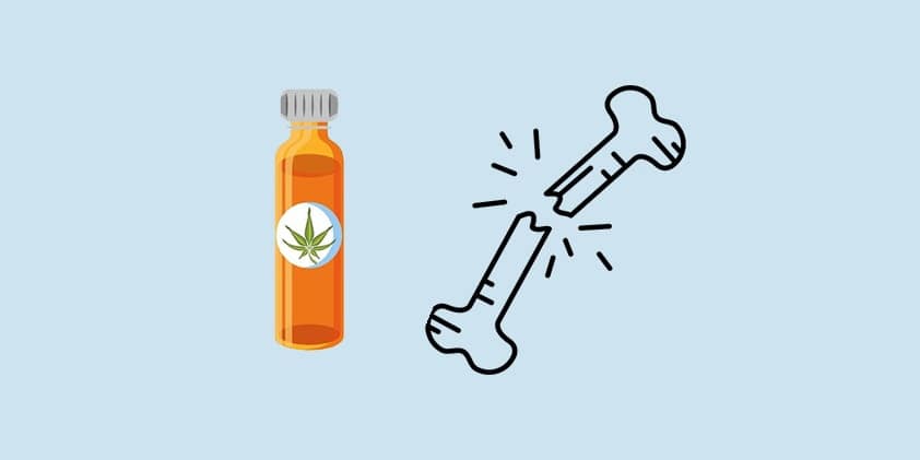 CBD as a Solution for Broken Bones, Osteoporosis and Arthritis
