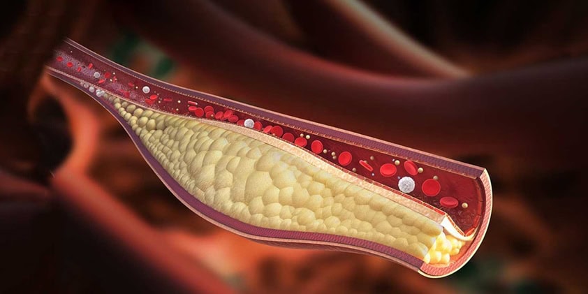 How Does CBD Oil Interact With Cholesterol Levels?