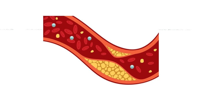 CBD For Cholesterol