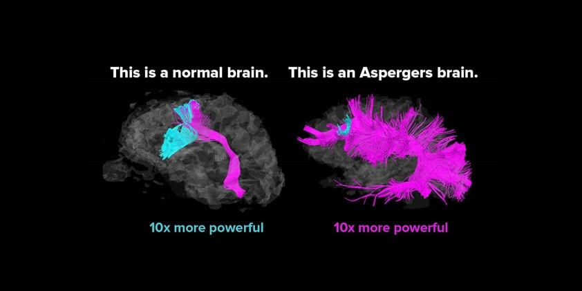 CBD and Asperger Syndrome