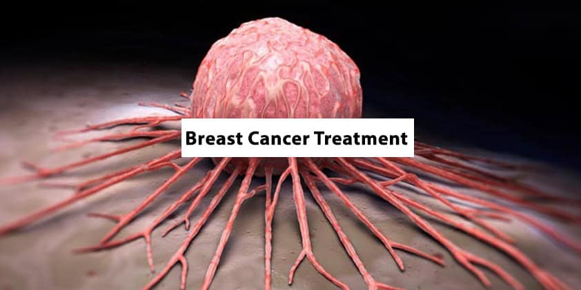 CBD Benefits for Breast Cancer Treatment