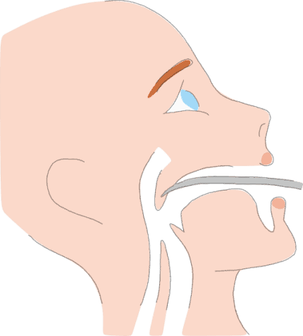 Radio-frequency ablation for snoring Radio-frequency ablation for snoring