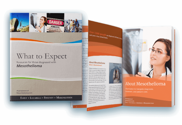 Free Mesothelioma Treatment Guide