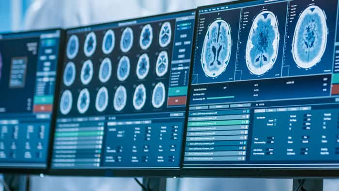 Teleradiologia – system komputerowy Teleradiologia - system komputerowy