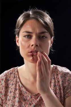 Does your husband beat you when you are successful?