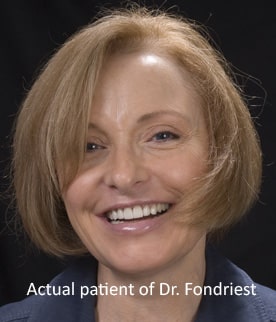 Example of smile makeover testimonials-5