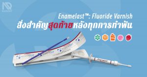Fluoride Varnish