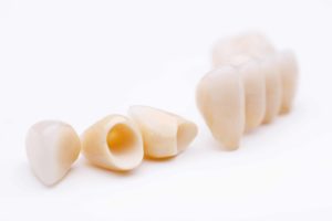 How To Fix A Cavity