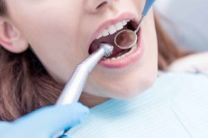 Preventing Plaque and Tartar