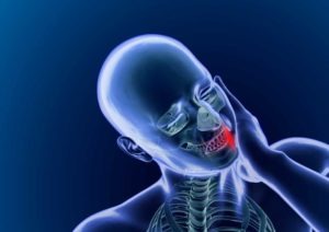 chronic jaw pain