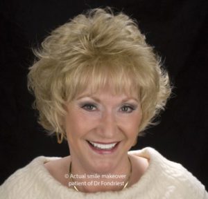 Teeth whitening for a bright white smile