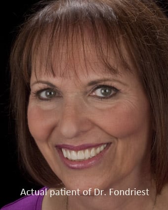 Smile Makeover testimonials-1
