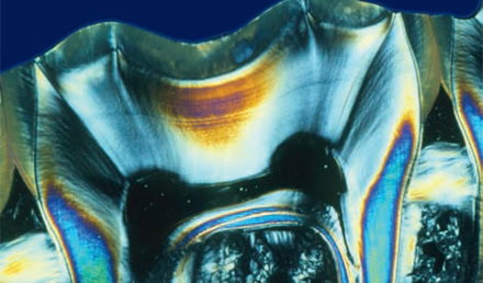 Management of Acute Orofacial Pain Syndromes Management of Acute Orofacial Pain Syndromes