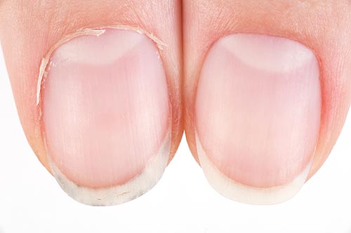 fingernail comparison