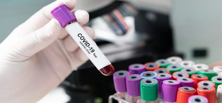 Active COVID-19 Infection Is Indicated by WBC ≤7.0 and PLT ≤200 at Presentation Active COVID-19 Infection Is Indicated by WBC ≤7.0 and PLT ≤200 at Presentation
