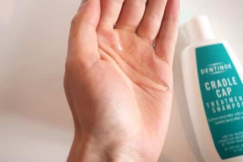 dentinox cradle cap oil