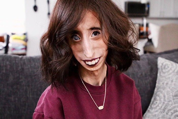 How Would You React When You Are Named The Ugliest Woman On Earth