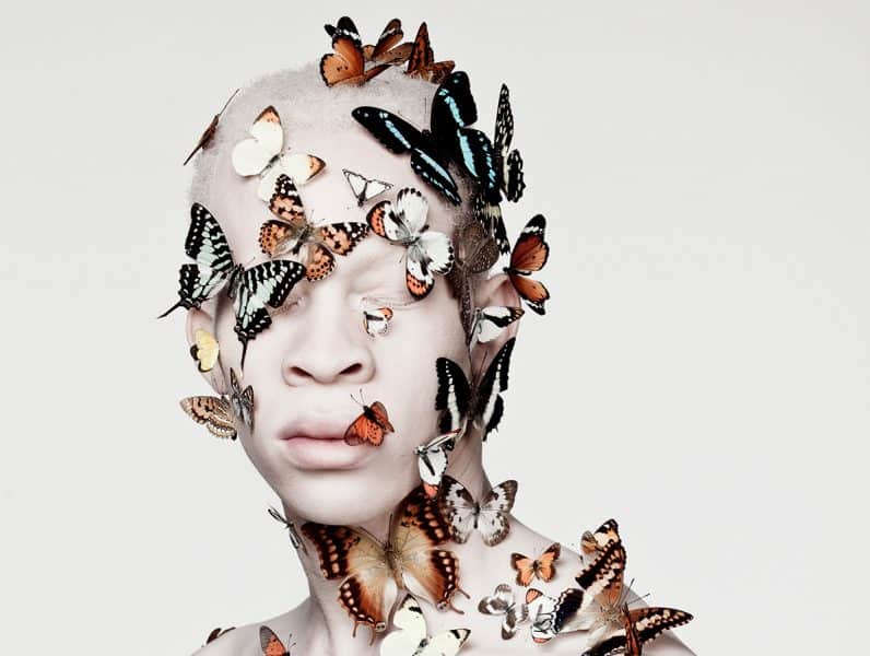 Models with Albinism Challenge Standards of Beauty 1 Models with Albinism